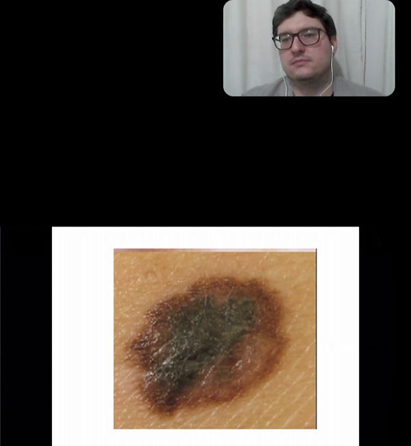 Cosmética para Estética - UNIESI e Sociedade Brasileira de Dermatologia